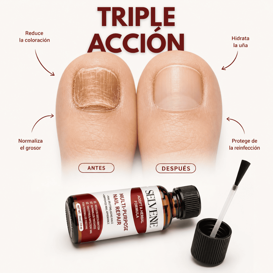 Sérum Anti Fúngico Selvenne - Triple Acción Para Tus Uñas